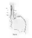 Fig. 46 - Devices, systems and methods for treating tissue regions of the body