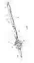 Fig. 49 - Devices, systems and methods for treating tissue regions of the body