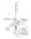 Fig. 01 - Tissue extraction devices and methods