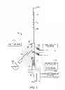Fig. 02 - Tissue extraction devices and methods