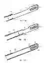 Fig. 11 - Tissue extraction devices and methods
