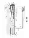 Fig. 14 - Tissue extraction devices and methods
