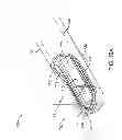 Fig. 18 - Tissue extraction devices and methods