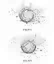 Fig. 23 - Tissue extraction devices and methods