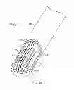 Fig. 27 - Tissue extraction devices and methods
