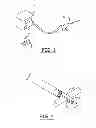 Fig. 02 - TISSUE SEALING METHOD