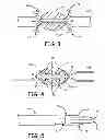 Fig. 03 - TISSUE SEALING METHOD