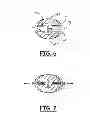 Fig. 04 - TISSUE SEALING METHOD