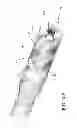 Fig. 08 - Composite material bone implant