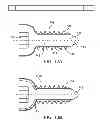 Fig. 11 - Composite material bone implant