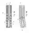 Fig. 22 - Composite material bone implant