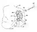 Fig. 01 - Apparatus and method for repairing bone defects