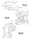 Fig. 04 - Apparatus and method for repairing bone defects