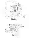 Fig. 10 - Apparatus and method for repairing bone defects