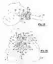 Fig. 11 - Apparatus and method for repairing bone defects