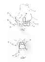 Fig. 02 - Method of arthroplasty on a knee joint and apparatus for use in same
