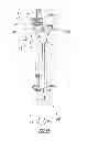 Fig. 08 - Method of arthroplasty on a knee joint and apparatus for use in same