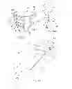 Fig. 09 - Method of arthroplasty on a knee joint and apparatus for use in same