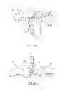 Fig. 22 - Method of arthroplasty on a knee joint and apparatus for use in same