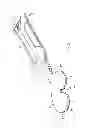 Fig. 03 - Method for performing an orthopaedic surgical procedure