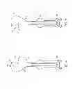 Fig. 04 - Method for performing an orthopaedic surgical procedure