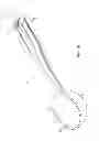 Fig. 12 - Method for performing an orthopaedic surgical procedure