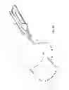 Fig. 16 - Method for performing an orthopaedic surgical procedure