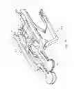 Fig. 23 - Method for performing an orthopaedic surgical procedure