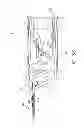 Fig. 26 - Method for performing an orthopaedic surgical procedure