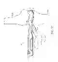 Fig. 33 - Method for performing an orthopaedic surgical procedure
