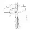 Fig. 36 - Method for performing an orthopaedic surgical procedure