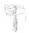 Fig. 37 - Method for performing an orthopaedic surgical procedure