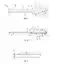 Fig. 02 - Device for performing a surgical procedure and methods of use