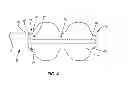 Fig. 03 - Device for performing a surgical procedure and methods of use