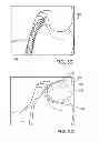 Fig. 07 - Flexible depth probe