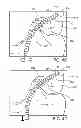 Fig. 09 - Flexible depth probe