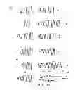 Fig. 10 - FLEXIBLE SPRING FASTENER