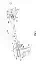 Fig. 02 - SURGICAL RETRIEVAL APPARATUS FOR THORACIC PROCEDURES