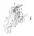 Fig. 03 - SURGICAL RETRIEVAL APPARATUS FOR THORACIC PROCEDURES
