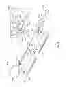 Fig. 04 - SURGICAL RETRIEVAL APPARATUS FOR THORACIC PROCEDURES