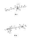 Fig. 05 - SURGICAL RETRIEVAL APPARATUS FOR THORACIC PROCEDURES