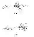 Fig. 08 - SURGICAL RETRIEVAL APPARATUS FOR THORACIC PROCEDURES
