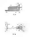 Fig. 09 - SURGICAL RETRIEVAL APPARATUS FOR THORACIC PROCEDURES