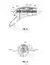 Fig. 11 - SURGICAL RETRIEVAL APPARATUS FOR THORACIC PROCEDURES