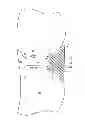 Fig. 03 - Method, apparatus and system for preventing or reducing the severity of hemorrhoids
