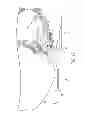 Fig. 10 - Method, apparatus and system for preventing or reducing the severity of hemorrhoids