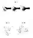 Fig. 06 - Hybrid control surgical robotic system
