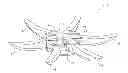 Fig. 01 - Surgical fastener having a snap lock and devices deploying it