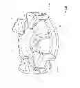 Fig. 06 - Surgical fastener having a snap lock and devices deploying it