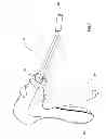 Fig. 07 - Surgical fastener having a snap lock and devices deploying it
